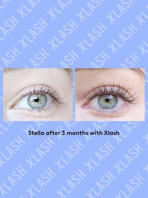 XLASH Pro Eyelash Serum 6 ml